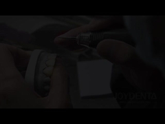 فنیرهای چمن فرنگی راه حل کامل برای فنیرهای طبیعی شفاف دندان