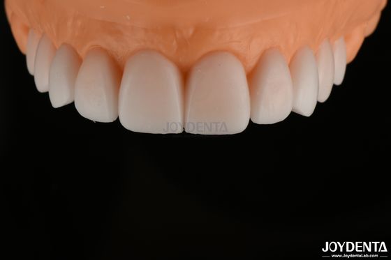 خرید موشک تشخیصي ريزي شده و درست FDA ، موشک دندانهاي کامل تولید آنلاین