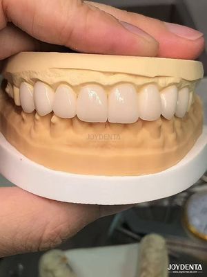 خرید 16 رنگ رنگ Emax Veneers دندان A1-A4 مقاومت بالا در برابر لکه برای لبخند کامل تولید آنلاین