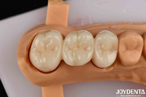 خرید مقاومت انعطاف پذیری بالا Zirconia برای تاج ها پل های ترمیم دندان تولید آنلاین