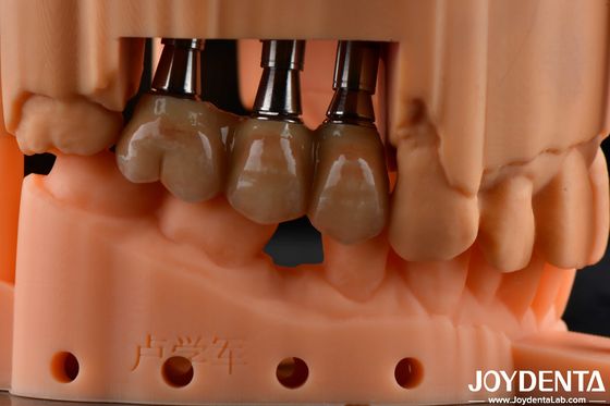 خرید مقاومت انعطاف پذیری بالا چند لایه مکمل Zirconia Dental Solution بازسازی کامل قوس تولید آنلاین