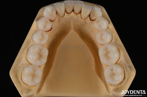 خرید 3D Multilayer دندانپزشکی مکمل Zirconia مقاومت در برابر شکستگی ساختار طبیعی دندان تولید آنلاین