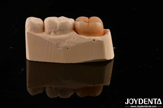 خرید مواد ترمیم دندان چند لایه ای Zirconia کامل 1200 HV سختی مقاومت در برابر ترک تولید آنلاین