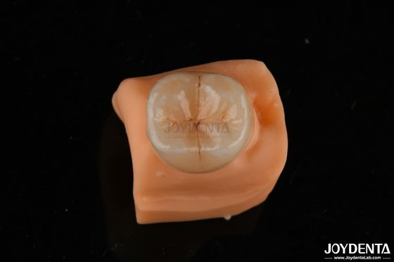 خرید 0.5mm مقاوم در برابر لکه ایماکس اینلی آنلی مناسب برای بازسازی دندان تولید آنلاین