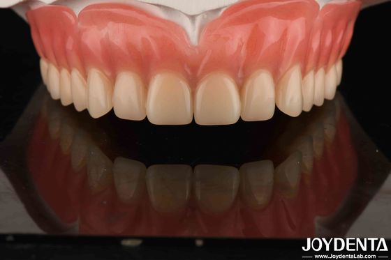 خرید دندان های آکریلیک مواد رزین سبک وزن بازسازی دندان های دندان ساز تولید آنلاین