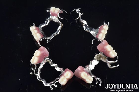 خرید چارچوب سفارشی برای استفاده از دندان ها تولید آنلاین