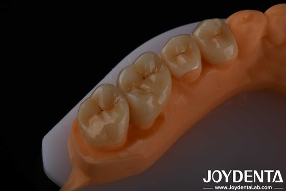خرید زیبایی شناسی بالا Zirconia Full Contour برای تاج ها پل ها ایمپلنت های دندان بازسازی تولید آنلاین