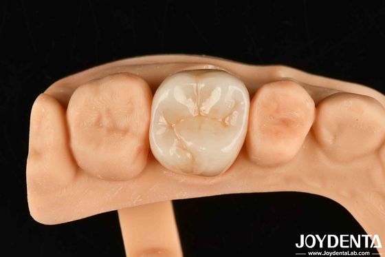خرید مقاومت بالا در برابر فرسایش دندانپزشکی Zirconia کامل تولید آنلاین