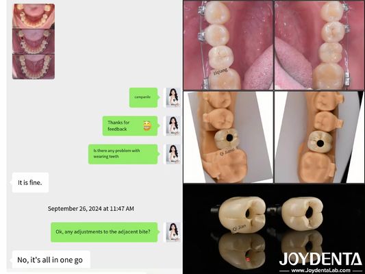خرید ایمپلنت های دندانی با قوس کامل طولانی مدت طول ایمپلنت اندوس 10mm-16mm تولید آنلاین