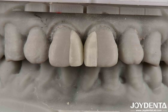 خرید سطوح منحنی مقاوم در برابر آتش مایکرو فنیر برای تزئینات داخلی تولید آنلاین