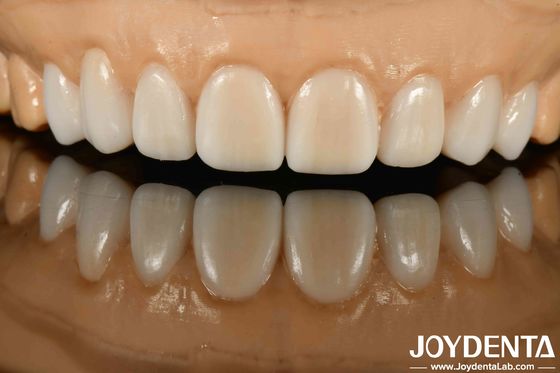 خرید مواد مختلف فلزات و رزین های انعطاف پذیر برای فن آوری پیشرفته مخفی تولید آنلاین