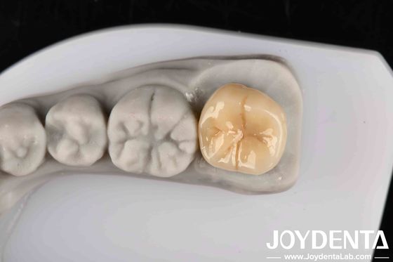 خرید مقاومت بالا در برابر شوک حرارتی و خوردگی زیرکون کامل با ثبات شیمیایی عالی تولید آنلاین