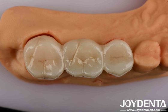 خرید زرکونیا دندانپزشکی با قدرت بالا راه حل نهایی شما برای زیبایی طبیعی تولید آنلاین