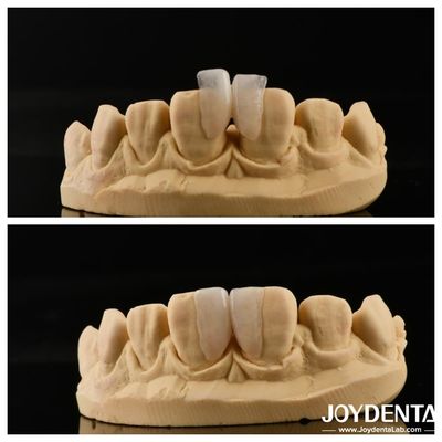 خرید آسان برای نصب مایکرو فنیر راه حل نهایی برای دکوراسیون داخلی ضخامت 0.2mm تولید آنلاین