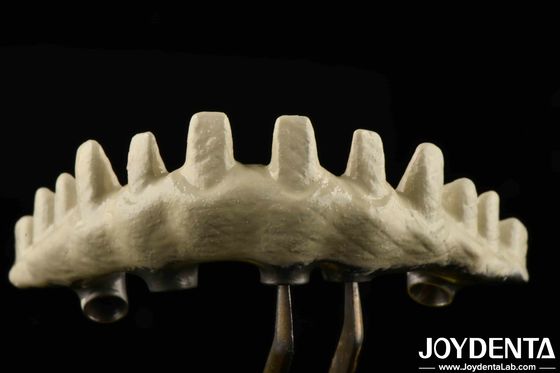 خرید نوع اتصال هکس داخلی طرح کاشت سفارشی Abutments شن و ماسه و اسید حک شده برای تناسب عالی تولید آنلاین