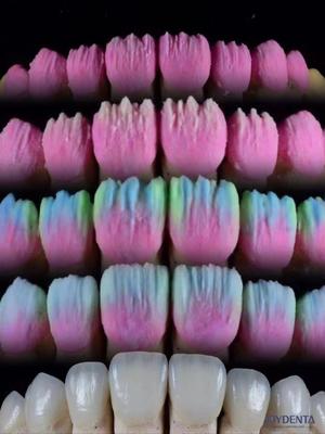 خرید The Joydenta Ceramic Veneer Process تولید آنلاین