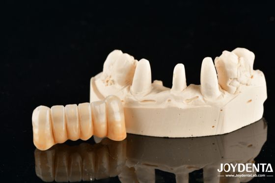 خرید Unveil True Biomimicry: Introducing Our Multi-Layered Zirconia Aesthetic Bridge تولید آنلاین