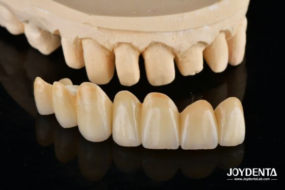 خرید Unveil True Biomimicry: Introducing Our Multi-Layered Zirconia Aesthetic Bridge تولید آنلاین