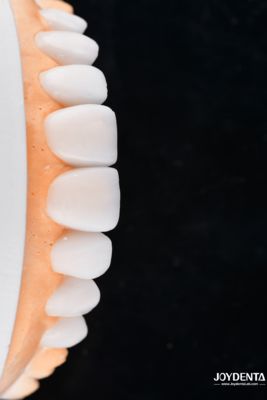 خرید Enhance Case Acceptance & Patient Communication with Our Diagnostic Wax-Up Service تولید آنلاین