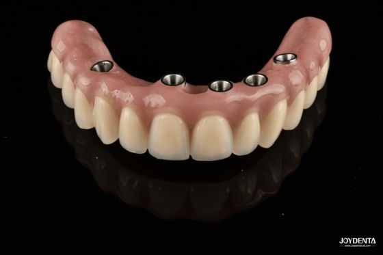 خرید Redefining Full Arch Prosthetics: Unmatched Fit and Function with Our Ti-Base Complete Dentures تولید آنلاین