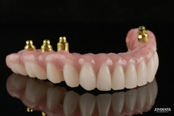 خرید The Strength of Titanium, The Art of Natural Aesthetics. تولید آنلاین