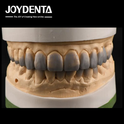 خرید استفاده موقت موشک تشخیصی موشک دندان های صاف تولید آنلاین