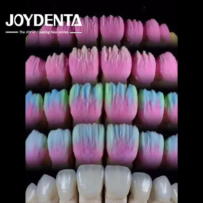 خرید The Joydenta Ceramic Veneer Process تولید آنلاین