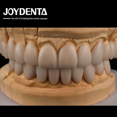 خرید 0.3mm ضخامت Ips Emax Veneers Veneers سرامیکی جلو و عقب بازسازی تولید آنلاین