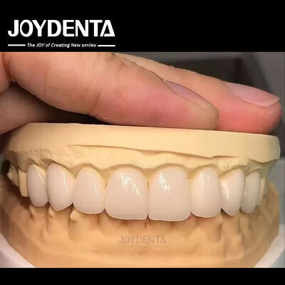 خرید 16 رنگ رنگ Emax Veneers دندان A1-A4 مقاومت بالا در برابر لکه برای لبخند کامل تولید آنلاین