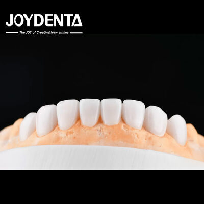 خرید Enhance Case Acceptance & Patient Communication with Our Diagnostic Wax-Up Service تولید آنلاین