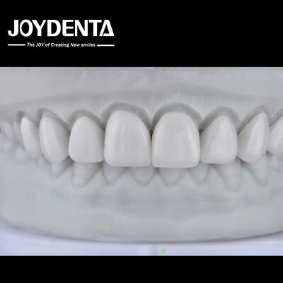 خرید Visualize the Result, Secure the Case: Our Diagnostic Wax-Up Service تولید آنلاین