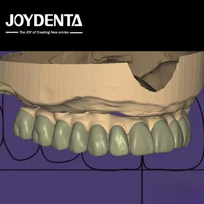 خرید طراحی فردی تشخیصی دیجیتال Wax Up Lab نرم افزار یکپارچه سازی تولید آنلاین