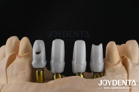 ایمپلنت دندان سفارشی زرکونیا Abutment برای بازسازی واحد یا چند واحد