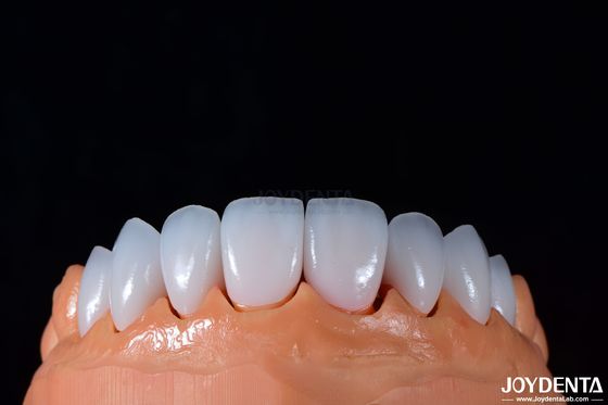 0.3-0.5mm ضخامت Emax فرنیر پورسلین برای دندانپزشکی زیبایی با درخشش بالا