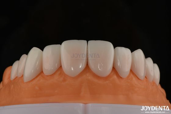 A1-A4 Ips Emax Press پورسلین فرنیچر دندان مقاوم به لکه شکل قابل تنظیم