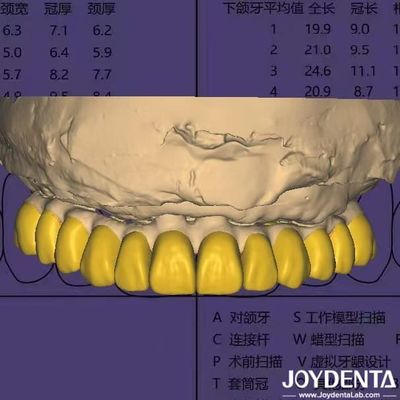 نرم افزار طراحی دندانپزشکی Digital Wax Up با امنیت داده های سازگار با HIPAA