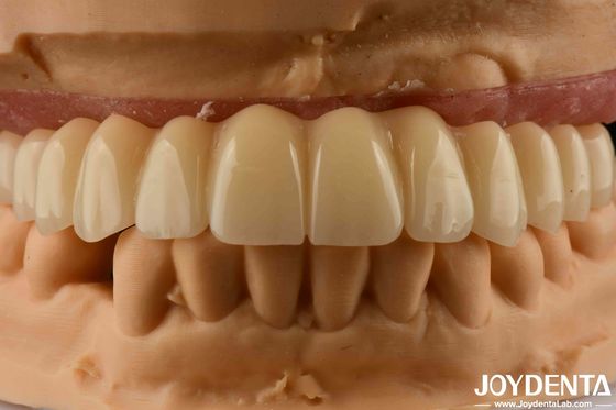 محلول دندان Ti-Base Zirconia Hybrid Bridge سازگاری زیستی بالا ظاهر طبیعی