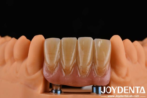 4.5mm ارتفاع Abutments به پایان رسیده نوع اتصال هکس داخلی سازگار با سیستم های ایمپلنت