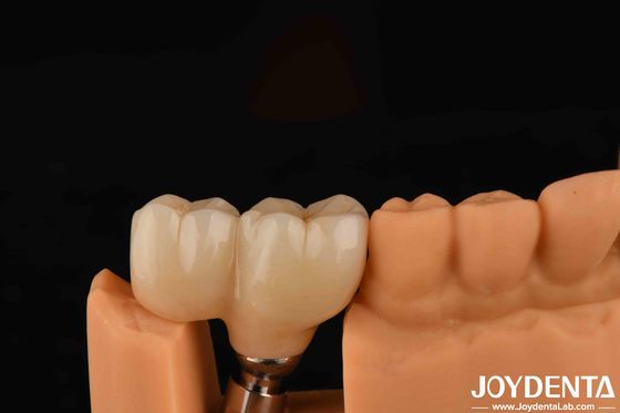 نوع رشته شکل V Abutments نهایی سازگاری با تمام سیستم های ایمپلنت اصلی