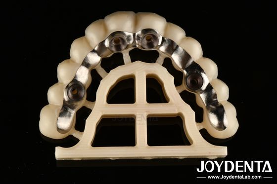نقره ای به پایان رساندن Abutments سفارشی و میله های دقیق مناسب پیچ نگه داشته شده یا سیمان نگه داشته شده