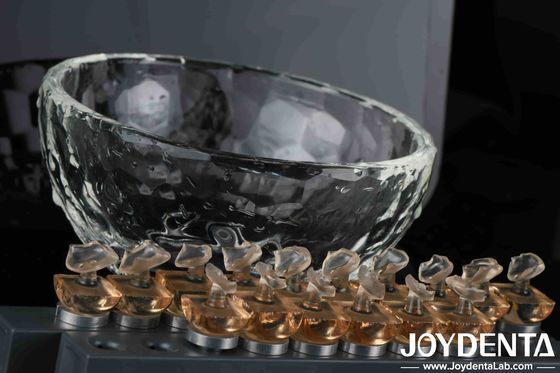 دندانپزشکی آرایشی فرنیر فرسنگ پخته شده آسان تمیز و مقاوم در برابر دما