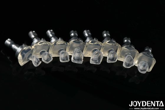 شیشه بسیار شفاف پورسلین دندانهای دندانی قدرت بالا 0.3-0.8mm ضخامت