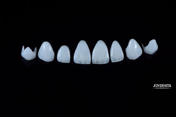 0.3-0.5mm ضخامت پورسلین طبیعی Emax Veneers قدرت بالا برای زیبایی