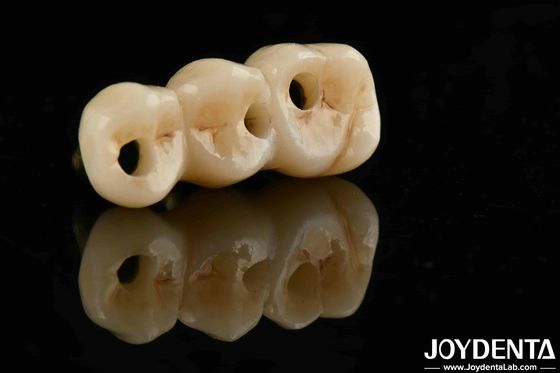 سازگاری بیولوژیکی عالی و قدرت بالا رنگ واقع بینانه Zirconia کامل برای راه حل های خرید B2B