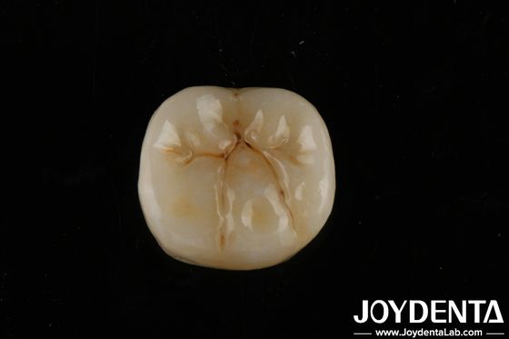 زيرکونياي پر شفاف با لايه هاي زيستي سازگاري و مقاومت خم 800 مگاپاه
