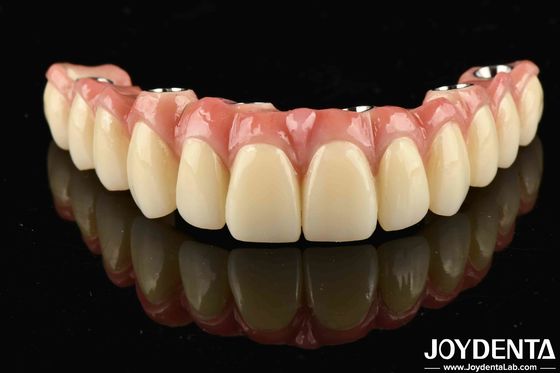 تراکم کم وزن سبک راحت برای پوشیدن پل هیبریدی تیتانیوم مالونگ برای عملکرد طولانی مدت
