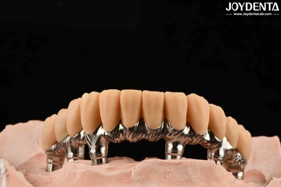 دندان‌های موقت رزین زرد سطح صاف درمان دقیق و پایدار