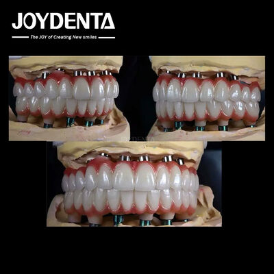 10mm تیتانیوم ایمپلنت دندان های چندگانه سطح خشن برای بازسازی دندان