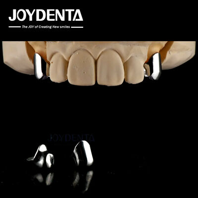 پروتز قابل جدا کردن دقیق ایمپلنت های دندانی لوازم جانبی آسان تمیز مناسب