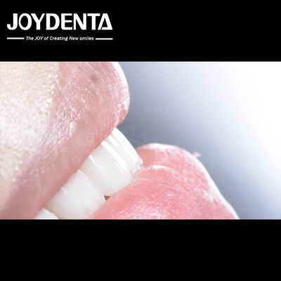 فنیر ترکیبی دندانپزشکی طولانی مدت سازگاری زیستی خوب بدون قطره فنیرهای چینی